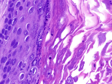 Imagen Microscópica Oncología