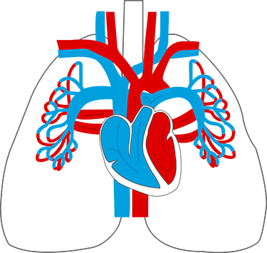 Illustrierter Lungenkreislauf: Lungenarterien transportieren sauerstoff-armes Blut vom Herzen zur Lunge.