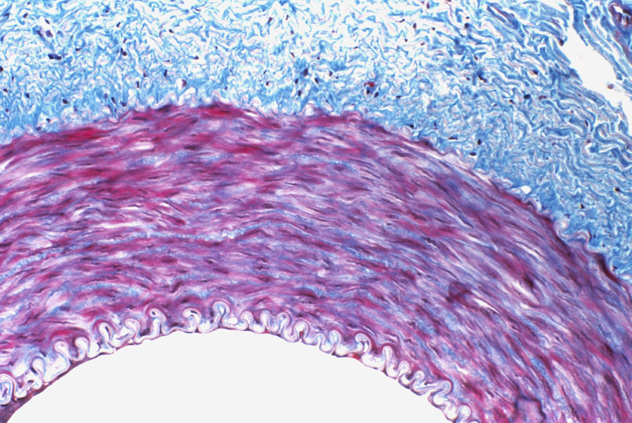 Detalhe de uma artéria humana vista ao microscópio.